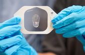 Breaking a sweat: Using chloride in sweat to help diagnose cystic fibrosis