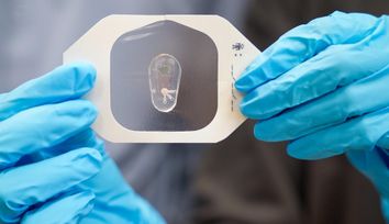 Breaking a sweat: Using chloride in sweat to help diagnose cystic fibrosis