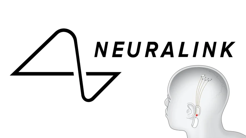 Neuralink: The Company That Wants To Put A Chip In Your Head