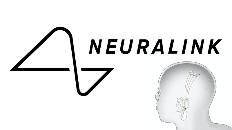 Neuralink: The Company That Wants To Put A Chip In Your Head