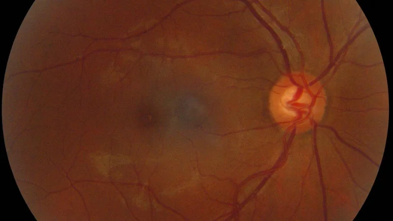 Computer Vision Inspecting the Human Eye
