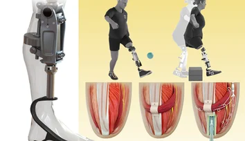 A bionic knee integrated into tissue can restore natural movement