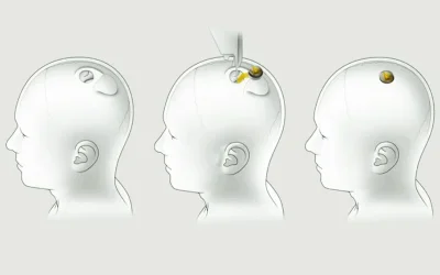 Podcast: Neuralink, Airspeeder: The Flying Car, Carbon Footprint & Computer Chips