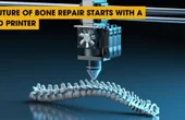 Future of Bone Repair Starts with a 3D Printer