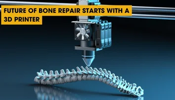 Future of Bone Repair Starts with a 3D Printer