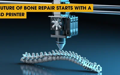 Future of Bone Repair Starts with a 3D Printer