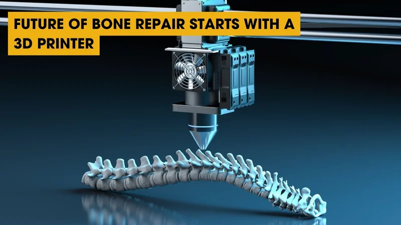 Future of Bone Repair Starts with a 3D Printer