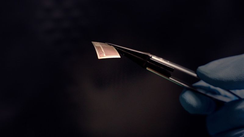 The BISC implant shown here is roughly as thick as a human hair. Photo Credit: Columbia Engineering