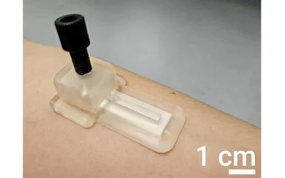 Self-Powered Patch Monitors Biomarkers Without Drawing Blood