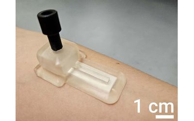 Self-Powered Patch Monitors Biomarkers Without Drawing Blood