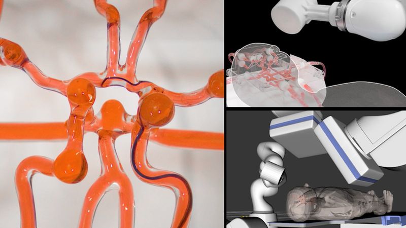 MIT engineers developed a telerobotic system to help surgeons remotely treat patients experiencing stroke or aneurysm. With a modified joystick, surgeons may control a robotic arm at another hospital to operate on a patient. Courtesy of the researchers