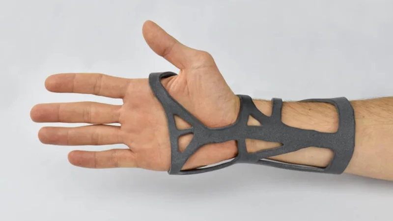 3D printing medical devices: What are the advantages ?