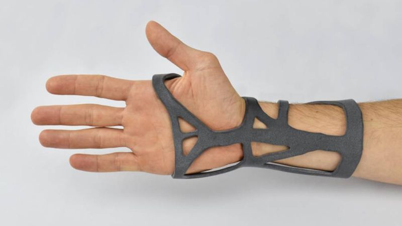 3D printing medical devices: What are the advantages ?