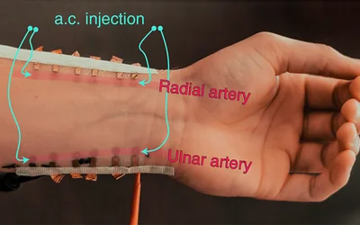 Blood pressure e-tattoo promises continuous, unobtrusive monitoring
