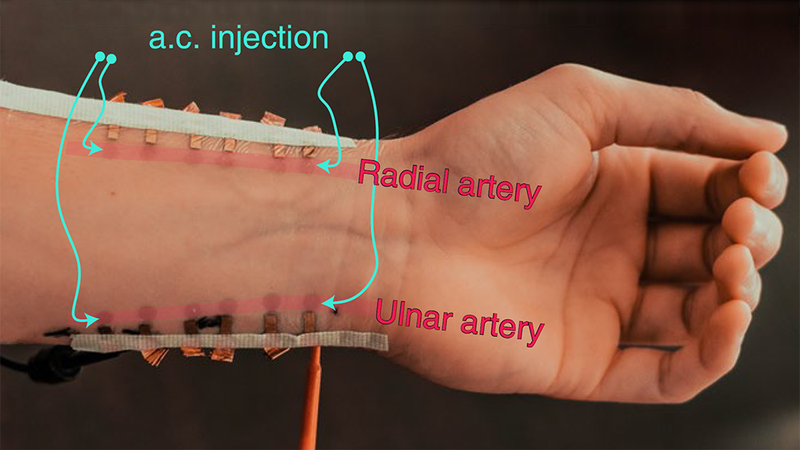 Graphene-based sensors are nearly invisible under the red markings, which are used to measure blood pressure. | Image: Courtesy of Dr. Roozbeh Jafari.