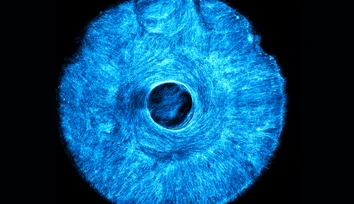 Artificial muscle flexes in multiple directions, offering a path to soft, wiggly robots