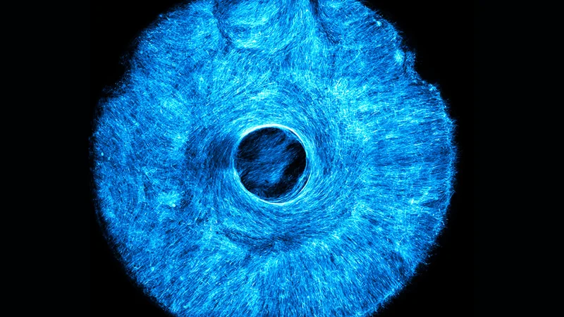 MIT engineers grew an artificial, muscle-powered structure that pulls both concentrically and radially, much like how the iris in the human eye acts to dilate and constrict the pupil. Image: Courtesy of the researchers