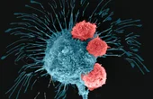 Podcast: Finding Better Cancer Cures By Printing Tumors