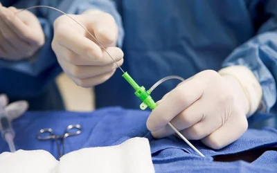 Sensing and Energy Systems for Minimally Invasive Cardiovascular Surgeries