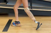 Revolutionizing prosthetics for kids: A modular approach that grows with the user