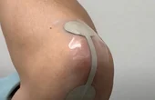 Stretchable silicone-based medical devices with AgCl fillers?