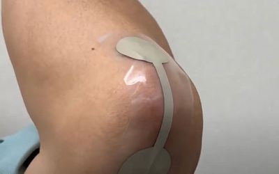 Stretchable silicone-based medical devices with AgCl fillers?