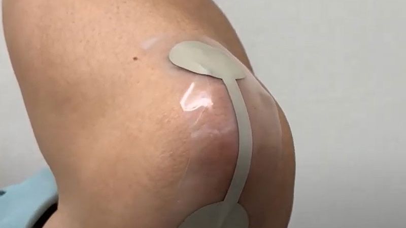 Stretchable silicone-based medical devices with AgCl fillers?