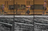 ProbeFix Dynamic crucial for ultrasound imaging of hamstring muscle and fascicle behaviour.