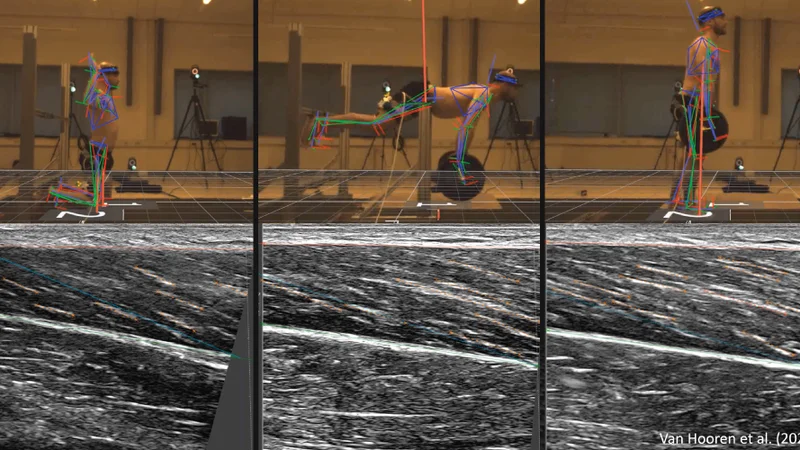 Synched ultrasound (Telemed ArtUs with Usono ProbeFix Dynamic T) and motion capturing with Vicon