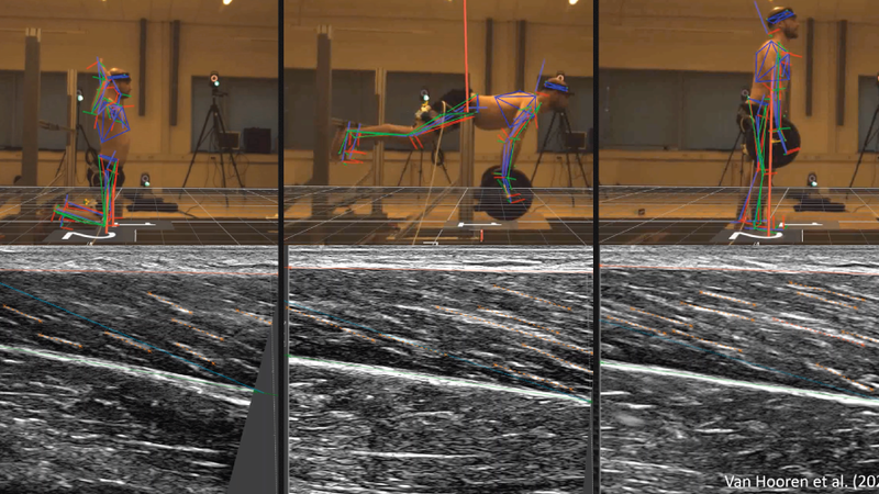 Synched ultrasound (Telemed ArtUs with Usono ProbeFix Dynamic T) and motion capturing with Vicon