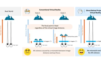 The Focus-Free Advantage of Direct Retinal Projection