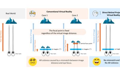 The Focus-Free Advantage of Direct Retinal Projection