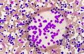Harnessing the OKdo Nano C100 Developer Kit for Leukemia Classification