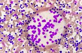 Harnessing the OKdo Nano C100 Developer Kit for Leukemia Classification