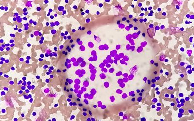 Harnessing the OKdo Nano C100 Developer Kit for Leukemia Classification