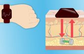 Miniature Device Offers Peace of Mind for Diabetics