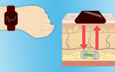Miniature Device Offers Peace of Mind for Diabetics