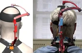 Podcast: Detecting Cancer In Pee, Robotic Neck Brace, Quieter Airplanes