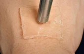 Strong adhesion thanks to cavitation bubbles