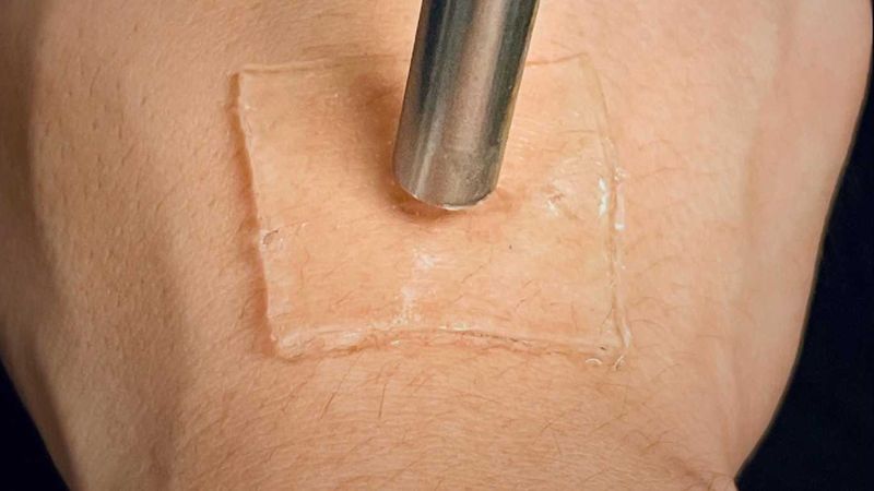 Ultrasound can be used to anchor the gel patch strongly to the skin.  (Photograph: Ran Huo & Jianyu Li, McGill University)