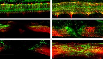 Magnetoelectric microrobots for spinal cord injury regeneration