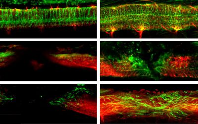 Magnetoelectric microrobots for spinal cord injury regeneration