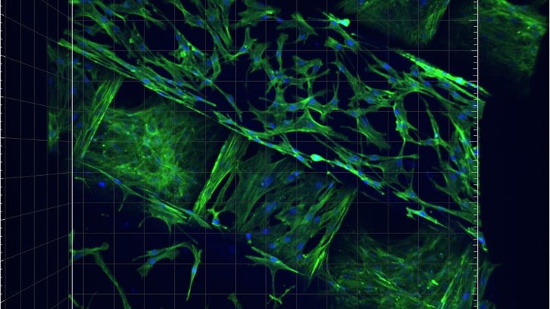 3D cell-scaffold interaction