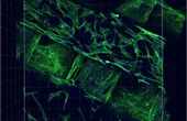 Tissue Engineering and 3D Printing: Two Revolutionary Disciplines Now Fused Into One