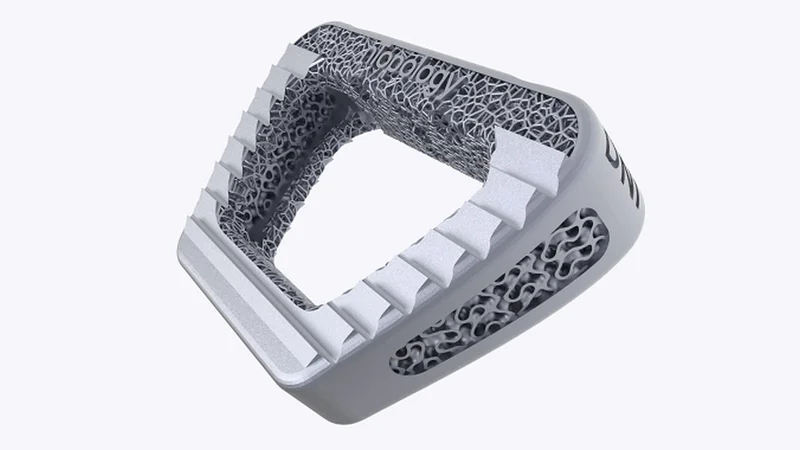 4 Ways to Accelerate the Development of Medical Implants with Design Automation