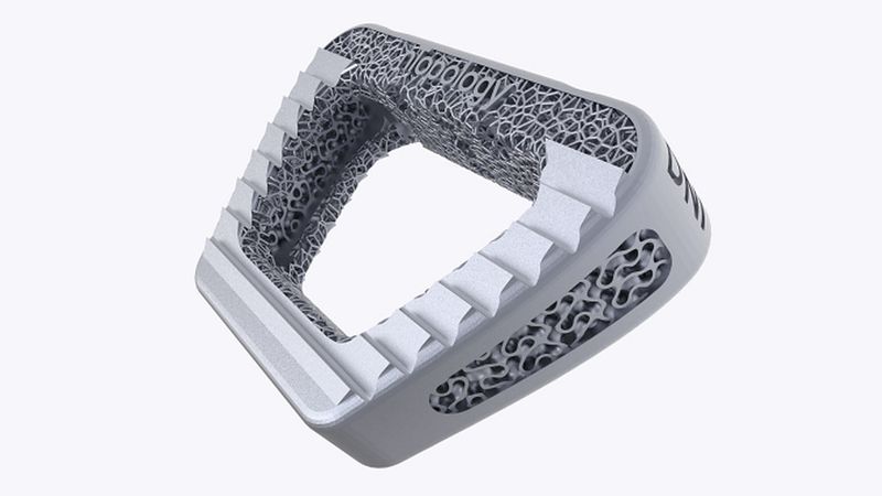 4 Ways to Accelerate the Development of Medical Implants with Design Automation