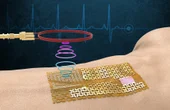 Engineers fabricate a chip-free, wireless electronic "skin"