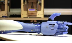 0.odn7ujstxc3dprosthesis