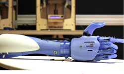 0.odn7ujstxc3dprosthesis