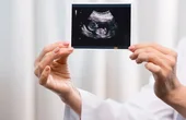Making way for a digital twin of the human placenta